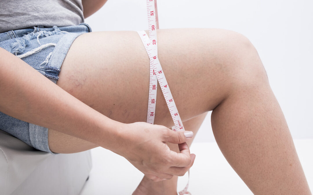 is-it-possible-to-lose-thigh-fat-in-two-weeks?:-healthifyme